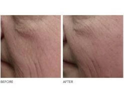 Dr. Dennis Gross Skincare DRx SpectraLite™ FaceWare Pro -Care Products Store 02xa1d1l 201908291835367992