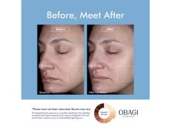 OBAGI Clinical® Dark Spot Disruptor Discoloration Correcting Serum 10 OBAGI Clinical® Dark Spot Disruptor Discoloration Correcting Serum -Care Products Store 0k3f0tw0 202206231539386305