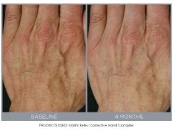 Jan Marini ReNu Corrective Hand Complex -Care Products Store 0qa4j5fx 201809111634090177