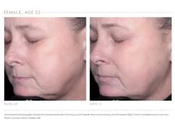 Emepelle Night Cream 20 Emepelle Night Cream -Care Products Store 0s05livo 202102161742422007