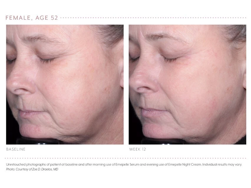 Emepelle Night Cream 11 Emepelle Night Cream - Image 9