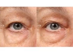 Epionce Luminous Eye Serum -Care Products Store 0tqle4eu 202111171535137397