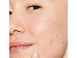 Dermalogica Deep Acne Liquid Patch 16 Dermalogica Deep Acne Liquid Patch -Care Products Store 1gznujvq 202305111858272143