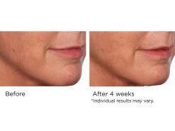 NassifMD® Pure Hydration Rejuvenating Night Cream -Care Products Store 1nqmgyly 202103051435143386