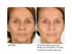 NassifMD® Hydro-Screen Hydrating Serum -Care Products Store 1rdzsqkk 202009231641228242