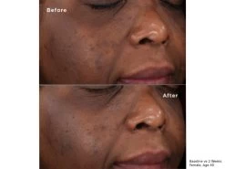 SkinMedica LYTERA 2.0 Pigment Correcting Serum -Care Products Store 2pwyrnjc 202012151922382870