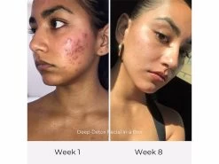 Olga Lorencin Skin Care Deep Detox Facial In A Box -Care Products Store 34iwlaa2 202204181735378369