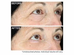 StriVectin Hyperlift Eye Instant Eye Fix 10 StriVectin Hyperlift Eye Instant Eye Fix -Care Products Store 3cehknyx 202106302124155873