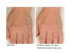 NassifMD® Hydro-Screen Hydrating Serum -Care Products Store 3dxtnqtx 202009231642060135