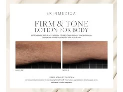 SkinMedica Firm & Tone Body Lotion -Care Products Store 3faqllj4 202208182047224121