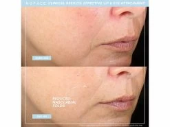 NuFACE TRINITY+ And Effective Lip & Eye Attachment -Care Products Store 3p1oooz3 202206221434201751
