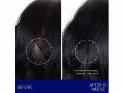 Augustinus Bader The Scalp Treatment -Care Products Store 3ue2tpdf 202302201956512205