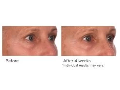 NassifMD® Pure Hydration Rejuvenating Night Cream -Care Products Store 3yrdgb3q 202103051434479563