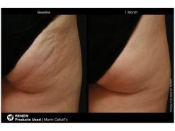 Jan Marini CelluliTx Cellulite Cream -Care Products Store 3ywk5owh 201806111728537712