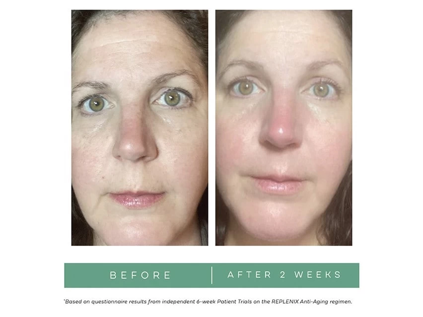 Replenix Age Restore Brightening Moisturizer 4 Replenix Age Restore Brightening Moisturizer - Image 2