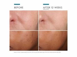 SkinCeuticals Phloretin CF Antioxidant Vitamin C Discoloration Serum -Care Products Store 4cjyvxp0 202206061645379033