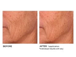 NassifMD® Hydro-Screen Intense Hydration Face & Body Soufflé -Care Products Store 4nd0tfmp 202009231651389197