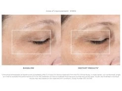 NuFACE FIX Starter Set 15 NuFACE FIX Starter Set -Care Products Store 4wwer1yo 201902041814305752