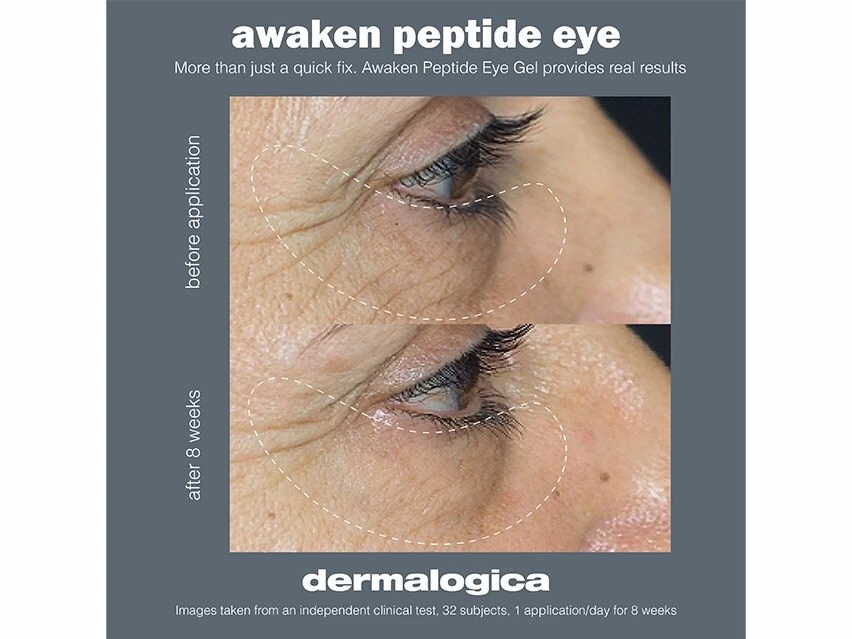 Dermalogica Awaken Peptide Eye Gel 6 Dermalogica Awaken Peptide Eye Gel - Image 4