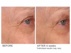 NassifMD® Age-Defying Eye Renewal Serum 14 NassifMD® Age-Defying Eye Renewal Serum -Care Products Store 5caovv0f 202202211740507276