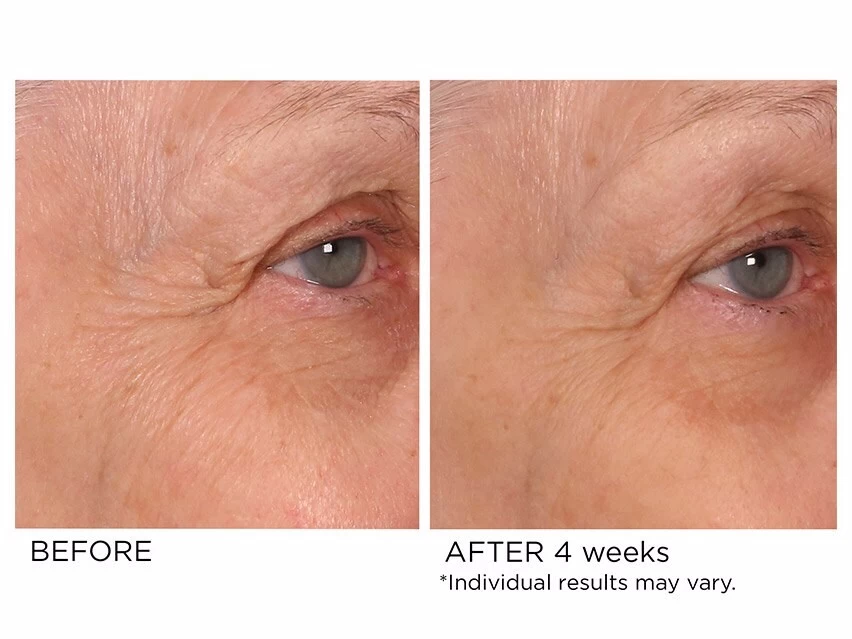 NassifMD® Age-Defying Eye Renewal Serum 8 NassifMD® Age-Defying Eye Renewal Serum - Image 6