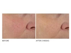 Dr. Dennis Gross Skincare Advanced Retinol + Ferulic Overnight Texture Renewal Peel 8 Dr. Dennis Gross Skincare Advanced Retinol + Ferulic Overnight Texture Renewal Peel -Care Products Store 5fl1mgii 202108121304467282