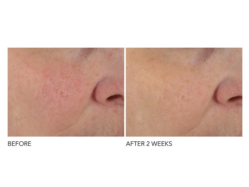 Dr. Dennis Gross Skincare Advanced Retinol + Ferulic Overnight Texture Renewal Peel 5 Dr. Dennis Gross Skincare Advanced Retinol + Ferulic Overnight Texture Renewal Peel - Image 3