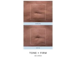 NuFACE NuBODY Skin Toning Device -Care Products Store aa45w1hr 202201101539199525