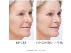 Peter Thomas Roth Instant FirmX Temporary Face Tightener -Care Products Store afvr0oj3 202109021829012341