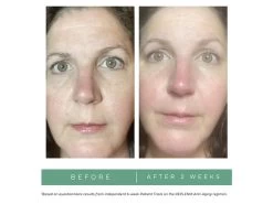 Replenix Age Restore Nighttime Therapy 13 Replenix Age Restore Nighttime Therapy -Care Products Store auv3tzpd 202208101814427925