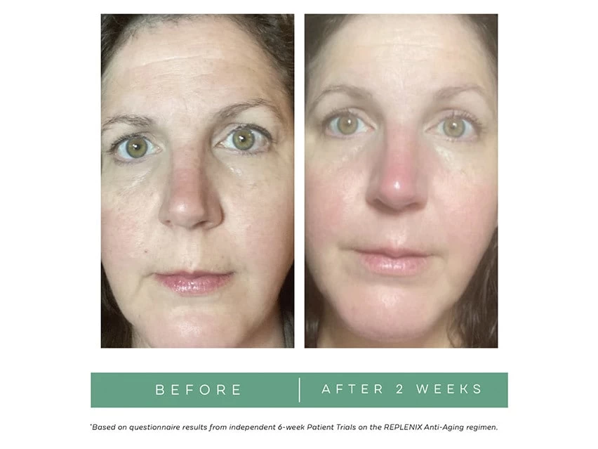 Replenix Age Restore Nighttime Therapy 8 Replenix Age Restore Nighttime Therapy - Image 6