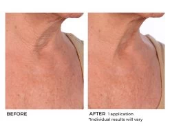 NassifMD® Hydro-Screen Intense Hydration Face & Body Soufflé -Care Products Store aw41iycr 202009231652049359