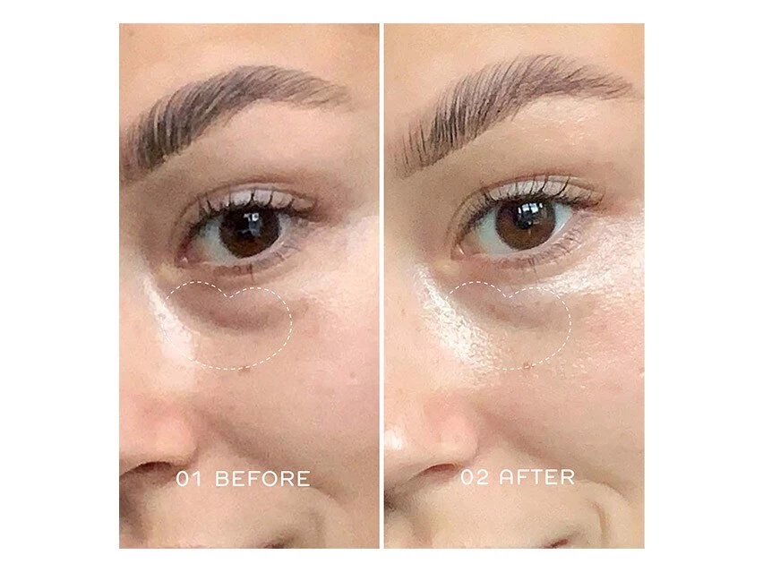 REN Clean Skincare Radiance Brightening Dark Circle Eye Cream 5 REN Clean Skincare Radiance Brightening Dark Circle Eye Cream - Image 3