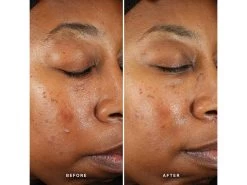 Alpha-H Generation Glow Daily Resurfacing Essence -Care Products Store az0wayuq 202203211446311168