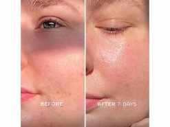 REN Clean Skincare Evercalm Barrier Support Face Oil 12 REN Clean Skincare Evercalm Barrier Support Face Oil -Care Products Store b3x4d4bh 202205031720316971