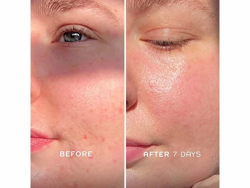 REN Clean Skincare Evercalm Barrier Support Face Oil 5 REN Clean Skincare Evercalm Barrier Support Face Oil - Image 3