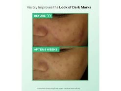 StriVectin Daily Brightening & Retexturizing Toner -Care Products Store bpzkk2jp 202303221448206985