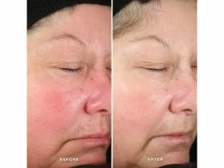 Alpha-H Generation Glow Daily Resurfacing Essence -Care Products Store bxjops4v 202203211448249339