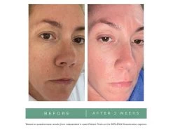 Replenix Pigment Correcting Brightening Cream -Care Products Store byo50slc 202208101823260838