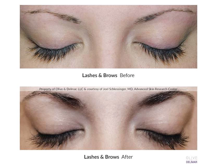 NeuLASH/neuBROW PROFESSIONAL™ By Skin Research Laboratories® Introductory Kit 4 NeuLASH/neuBROW PROFESSIONAL™ By Skin Research Laboratories® Introductory Kit - Image 2