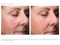 Emepelle Night Cream 17 Emepelle Night Cream -Care Products Store cxr5gdw3 202102161739306007