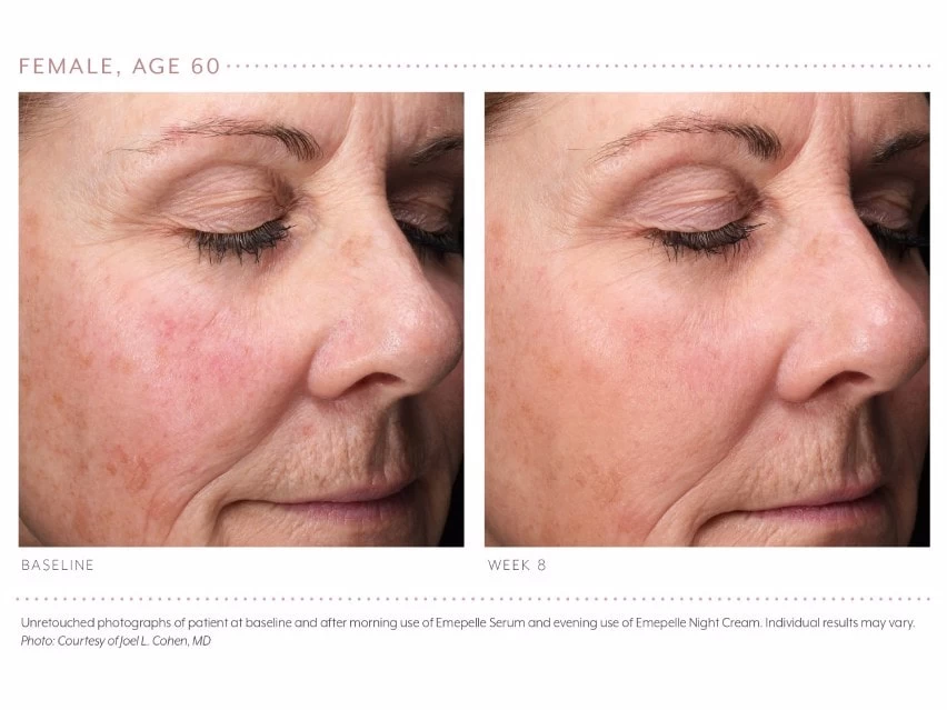 Emepelle Night Cream 8 Emepelle Night Cream - Image 6