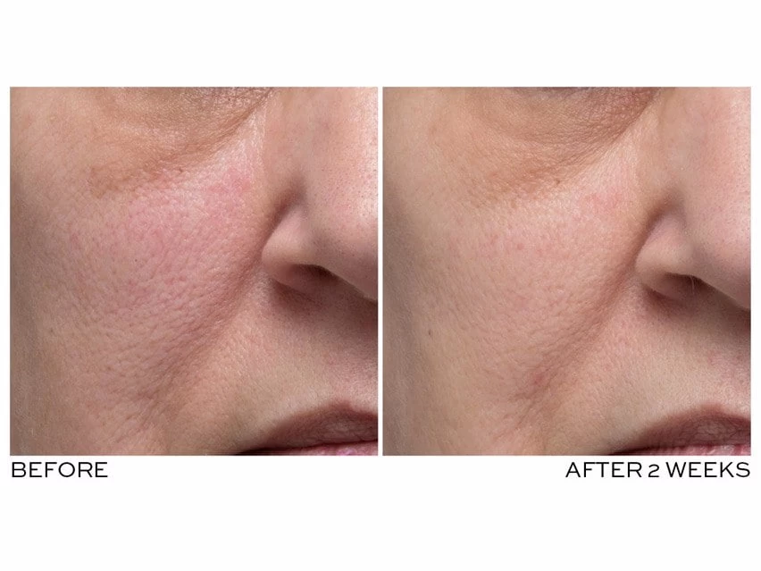 ELEMIS Peptide4 Adaptive Day Cream 5 ELEMIS Peptide4 Adaptive Day Cream - Image 3