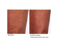 NassifMD® Crepe Inhibitor Triple Action Body Butter 13 NassifMD® Crepe Inhibitor Triple Action Body Butter -Care Products Store dbgmas0j 202009221703599309