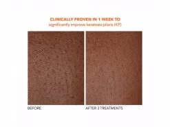 Dr. Dennis Gross Skincare Alpha Beta Exfoliating Body Treatment 20 Dr. Dennis Gross Skincare Alpha Beta Exfoliating Body Treatment -Care Products Store dggpqcrx 202102011547304478