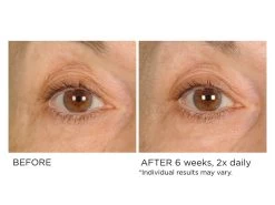 NassifMD® Anti-Aging Under Eye Smoother 9 NassifMD® Anti-Aging Under Eye Smoother -Care Products Store dhp2zebu 202009231841423602