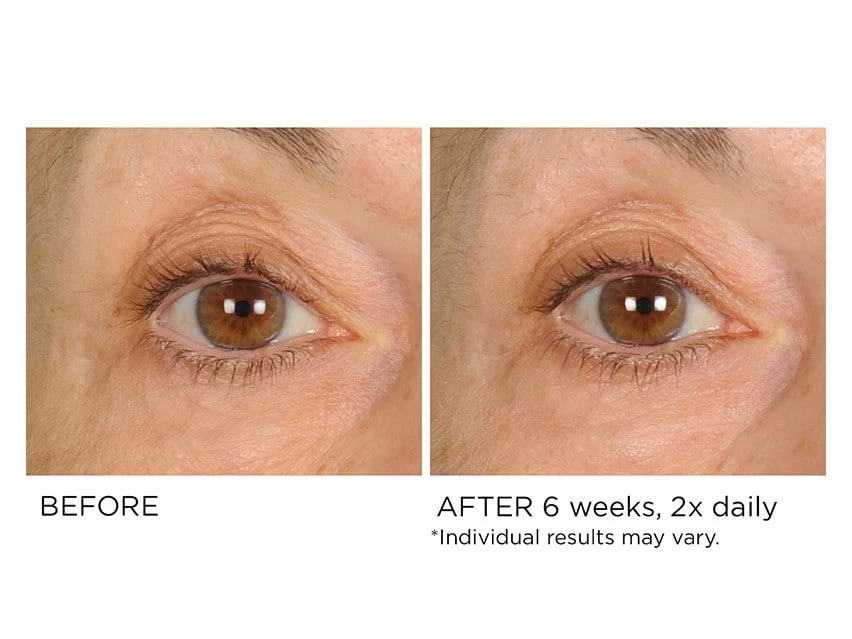 NassifMD® Anti-Aging Under Eye Smoother 6 NassifMD® Anti-Aging Under Eye Smoother - Image 4