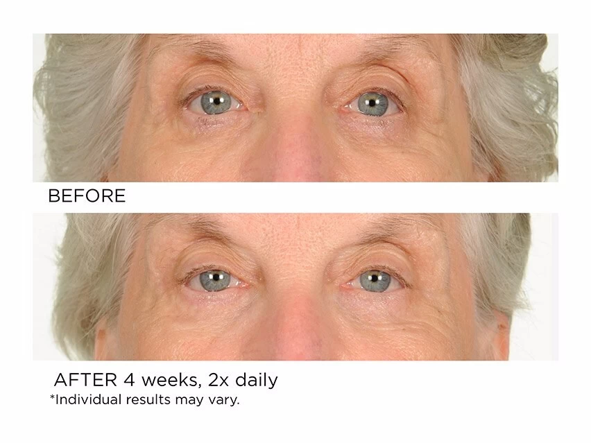 NassifMD® Anti-Aging Under Eye Smoother 4 NassifMD® Anti-Aging Under Eye Smoother - Image 2