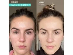 HUM Nutrition Daily Cleanse Dietary Supplement -Care Products Store dsue0bl4 202212191956398925