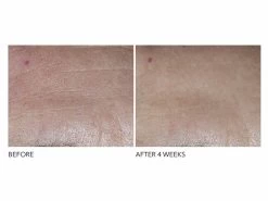 Dr. Dennis Gross Skincare Advanced Retinol + Ferulic Overnight Texture Renewal Peel 7 Dr. Dennis Gross Skincare Advanced Retinol + Ferulic Overnight Texture Renewal Peel -Care Products Store dt23wywk 202108121304214440